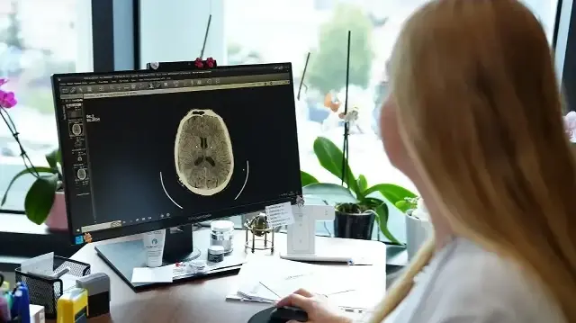 kume bas agrisi nedir belirtileri nelerdir uzmanindan onemli uyarilar TqxKlCI1.webp